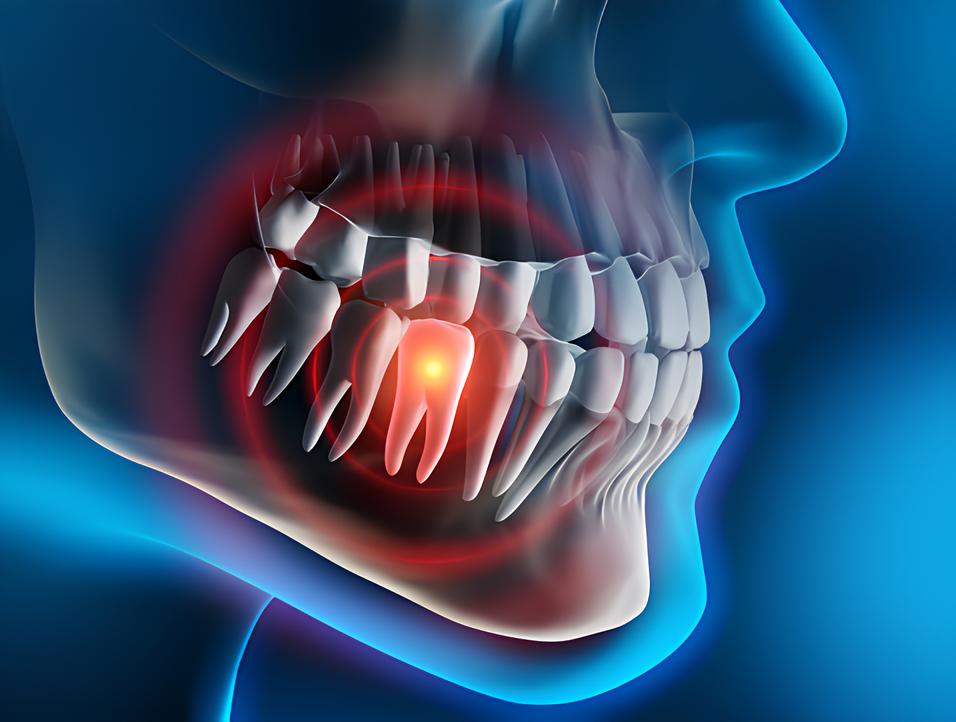 Teeth image - Emergency dentist Deal